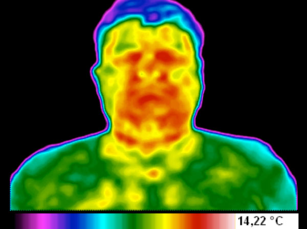 Termografia